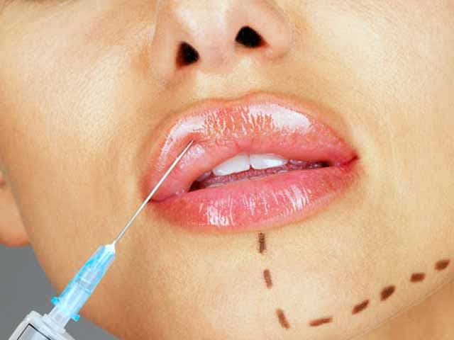 A no confundir botox con rellenos