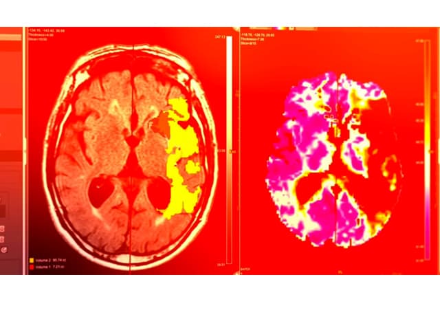 IA revolucionará la medicina