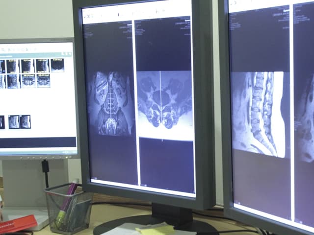 Philips amplía su cartera de informática