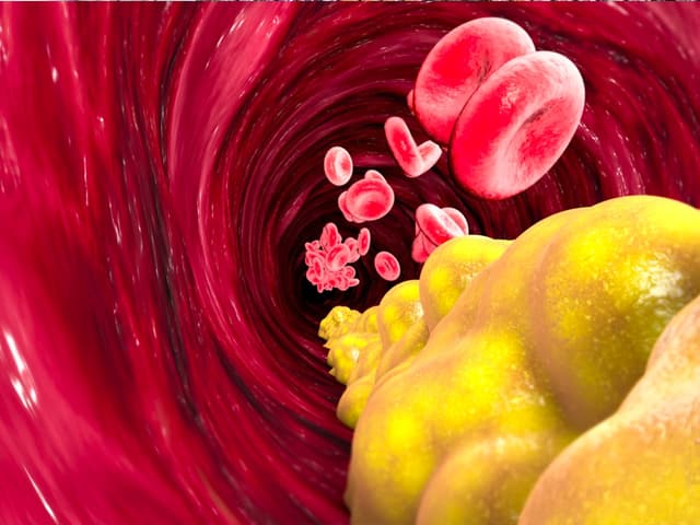 Colesterol, la última adquisición de Novartis