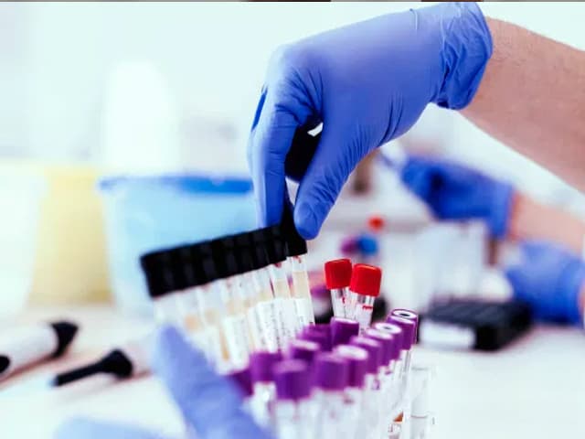 ¿La FDA aprueba drogas demasiado rápido?