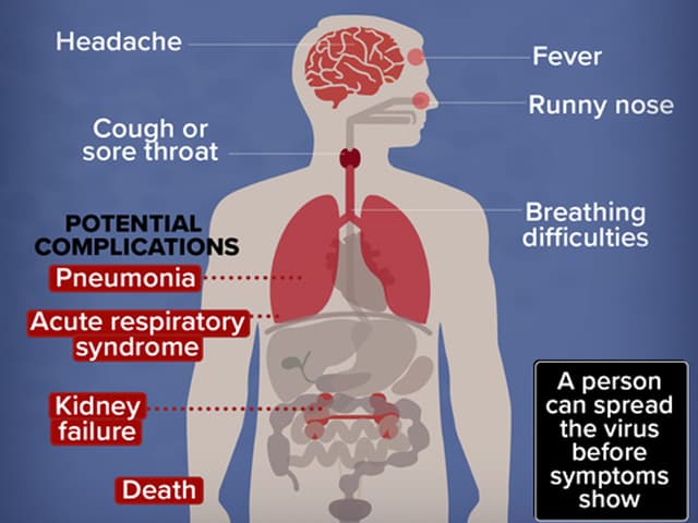 En qué consiste la enfermedad Covid 19