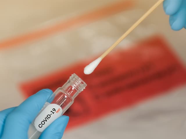 Empresa argentina produce hisopos en 3D para detectar Covid-19