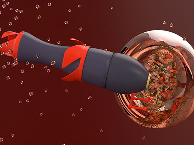 Un robot cuya misión es matar el cáncer