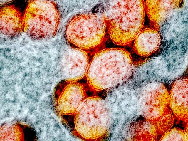 Estudian las mutaciones del virus