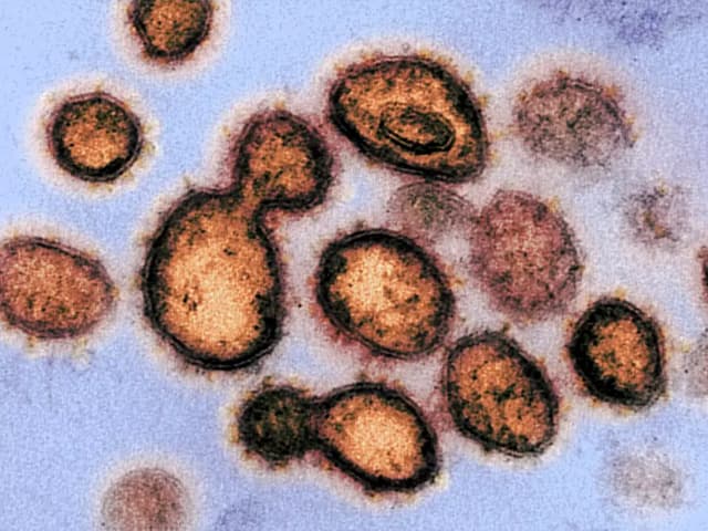 Moderna prueba vacuna contra las mutaciones del virus