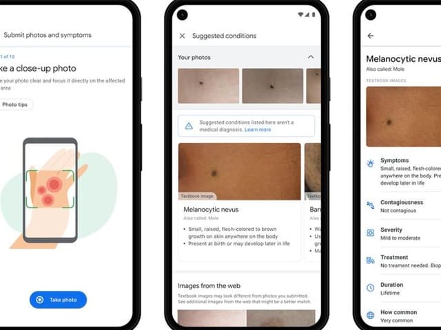 IA para diagnosticar problemas en la piel