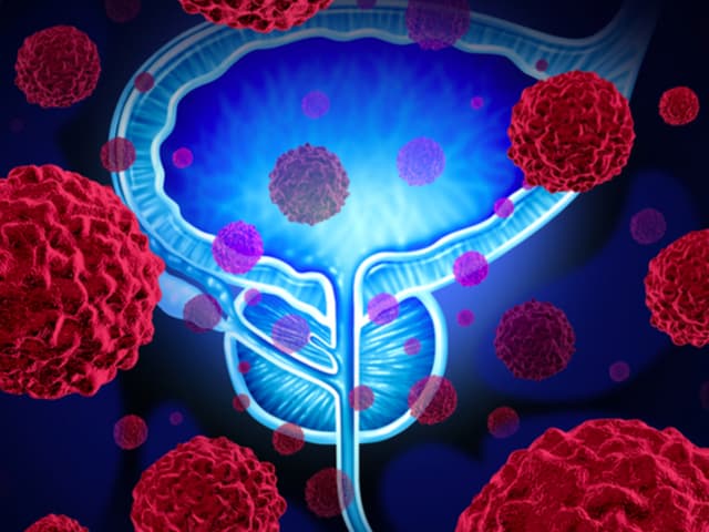 Novartis con una nueva terapia para el cáncer