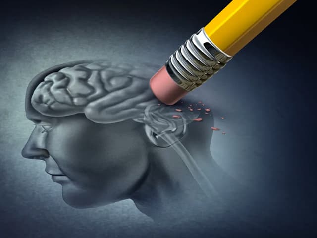 Esperanzador y polémico es el nuevo remedio para Alzheimer