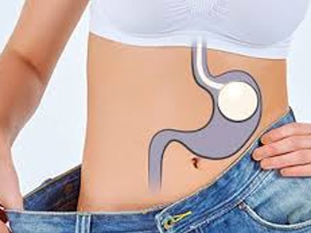 Nuevas técnicas para el sobrepeso y la obesidad 