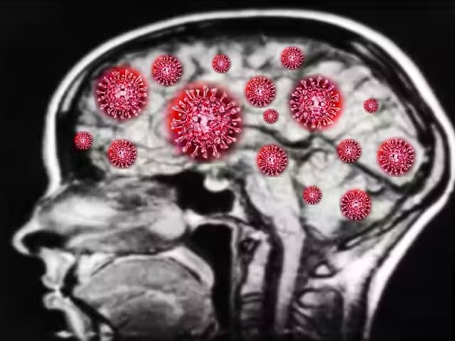 El cerebro después de COVID 19