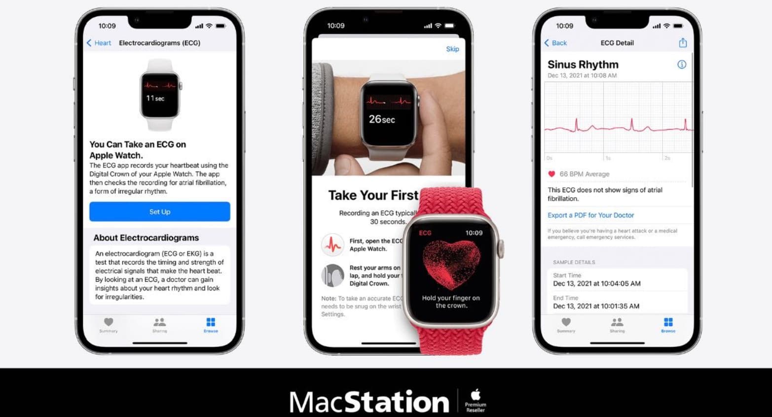 App ECG en Apple Watch: MacStation impulsa el bienestar digital